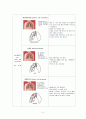 [성인]폐암 CASE (lung cancer CASE) 2페이지