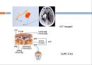 ICH 문헌고찰 ppt 3페이지