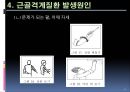 [의학] 근골격계 질환의 이해.ppt 12페이지