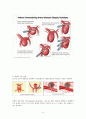 뇌동맥류(cerebral aneurysm)치료와 수술 후 간호 15페이지