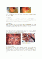 뇌동맥류(cerebral aneurysm)치료와 수술 후 간호 17페이지