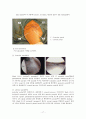 회전근개파열(Rotator cuff rupture)과 수술간호 17페이지