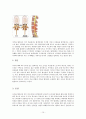 척추관협착증(spinal stenosis)과 치료 10페이지