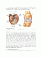 반월상연골제거수술(meniscectomy) 7페이지