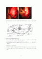 위암(Stomach cancer)과 위절제술(Gastrectomy) 14페이지