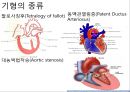 선천심장질환.ppt 4페이지