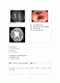 뇌졸증case(간호대학원) 6페이지