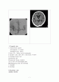 뇌졸증case(간호대학원) 7페이지