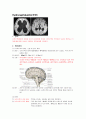 [신경외과] Hydrocephalus(뇌수두증) 1페이지