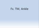 Fx. TM,Ankle(삼과골절).ppt 1페이지