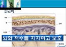 뇌출혈 case ppt 7페이지