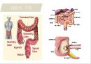 대장암, 대장내시경, 대장암치료20130524 4페이지