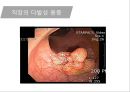 대장암, 대장내시경, 대장암치료20130524 30페이지