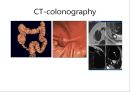 대장암, 대장내시경, 대장암치료20130524 44페이지