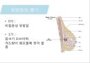 유방암, 바로 알고 이겨내자.ppt 52페이지