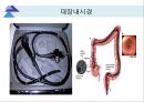 대장내시경에서 발견되는 소견 (대장 용종 및 대장암, 기타 소견).ppt 8페이지