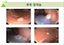 대장내시경에서 발견되는 소견 (대장 용종 및 대장암, 기타 소견).ppt 36페이지