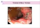 대장내시경에서 발견되는 소견 (대장 용종 및 대장암, 기타 소견).ppt 52페이지