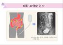 대장내시경에서 발견되는 소견 (대장 용종 및 대장암, 기타 소견).ppt 56페이지