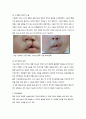 [아동 케이스] cleft palate 구개열 케이스 4페이지