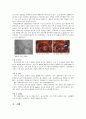 [성인간호 케이스] 동맥류 케이스 aneurysm case 5페이지