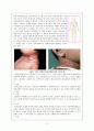 아동간호학 케이스 스터디 임파선염 (lymphadenopathy)  2페이지