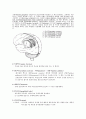 [의학] 뇌내출혈[intracerebral hemorrhage, ICH] 5페이지