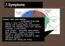 [의학] 외상성 뇌손상 - tbi[Traumatic Brain Injury] 13페이지