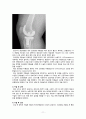 성인 골관절염간호과정 - 골관절염과 슬관절 케이스 스터디 (CASE STUDY ABOUT OSTEOARTHRITIS AND TOTAL KNEE REPLACEMENT) 11페이지