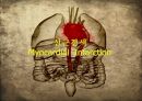 해부생리학 - 심근경색[Myocardial  Infarction]에 대해 1페이지