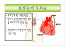 해부생리학 - 심근경색[Myocardial  Infarction]에 대해 11페이지