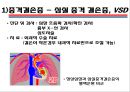 [의학] 선천성 심장질환[Congenital heart disease]에 관해 10페이지