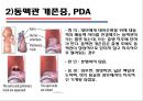 [의학] 선천성 심장질환[Congenital heart disease]에 관해 14페이지