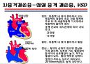 [의학] 선천성 심장질환[Congenital heart disease]에 관해 19페이지
