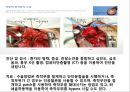 [의학] 선천성 심장질환[Congenital heart disease]에 관해 20페이지