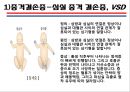 [의학] 선천성 심장질환[Congenital heart disease]에 관해 22페이지