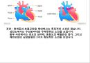 [의학] 선천성 심장질환[Congenital heart disease]에 관해 23페이지