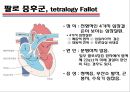 [의학] 선천성 심장질환[Congenital heart disease]에 관해 26페이지