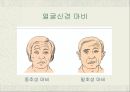 [신경계 물리치료 사례연구] 신경계case - 안면마비 15페이지