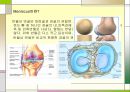 [의학] 반월상 연골판 손상.ppt 3페이지