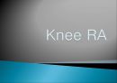 [질환별 물리치료] 무릎 류마티스관절염[Knee RA] 1페이지