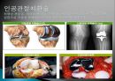 [질환별 물리치료] 무릎 류마티스관절염[Knee RA] 16페이지