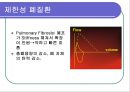 [심폐물리치료] 폐 기능의 검사 27페이지