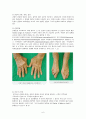[간호과] 류마티스관절염(Rheumatoid Arthritis) 케이스 스터디 6페이지