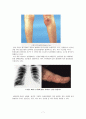 [간호과] 류마티스관절염(Rheumatoid Arthritis) 케이스 스터디 7페이지
