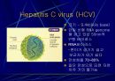 Hepatitis C 4페이지