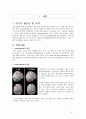 [정신분열병] 조현병에 대한 사례연구 (Schizophrenia) 케이스스터디 3페이지