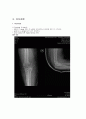 상지골절 (윤보나) 1페이지