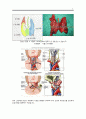 [성인간호학][Thyroid cancer][갑상선암][thyroidectomy] 수술실 케이스 스터디(Case Study), 문헌고찰 5페이지