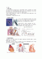 [성인간호학][Myocardial infarction][심근경색증][MI]문헌고찰.케이스 스터디(Case Study) 5페이지